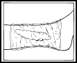 Emla crema-figura3